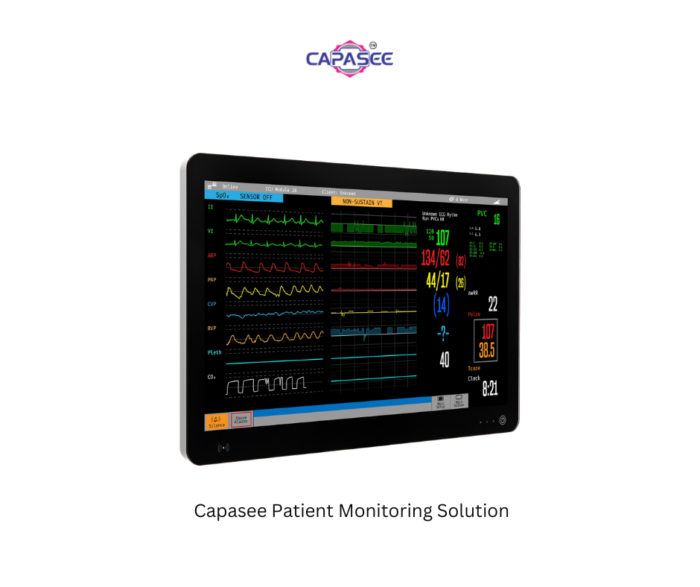 Capasee Patient Monitoring Solution