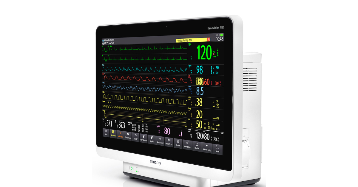 ease-of-use-and-user-friendly-interfaces