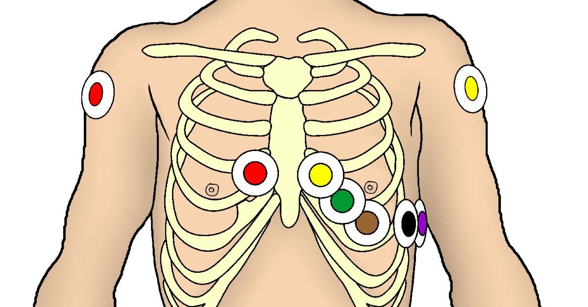 choosing-the-right-electrodes