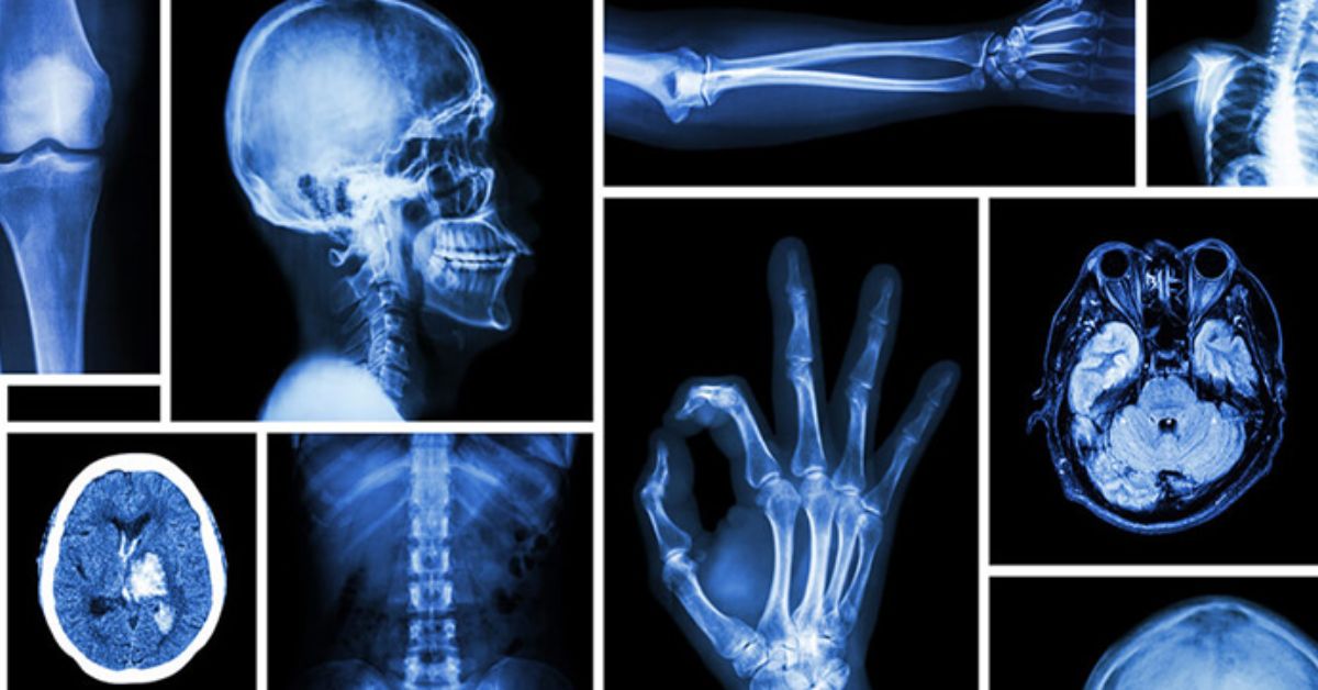 types-of-x-ray-viewers