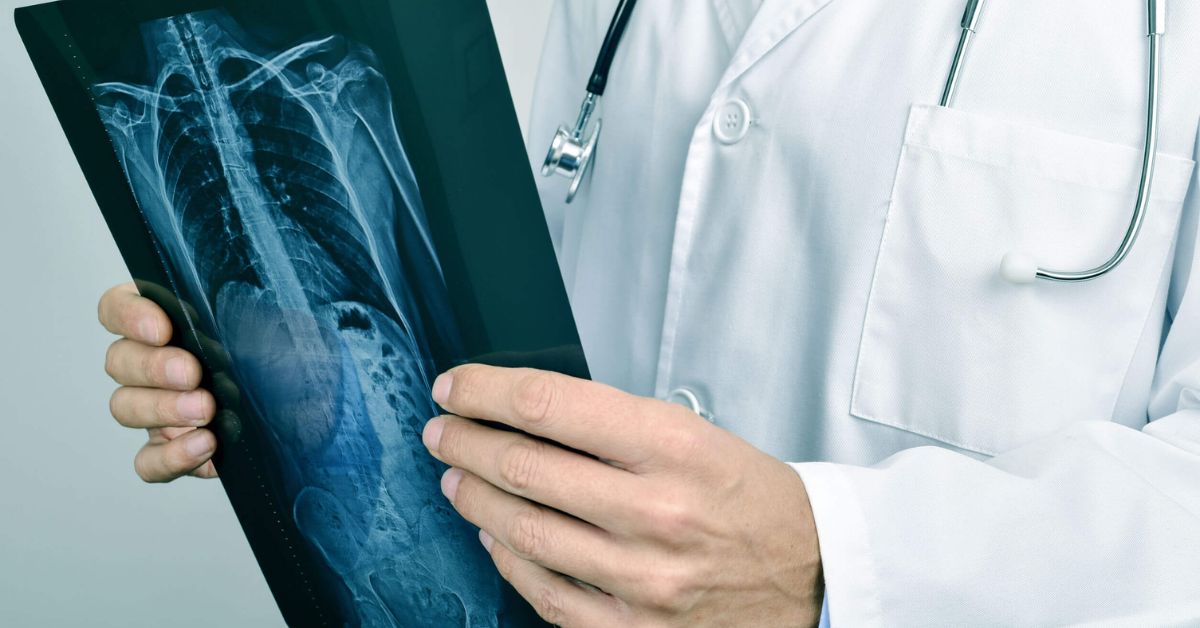 what-are-x-rays