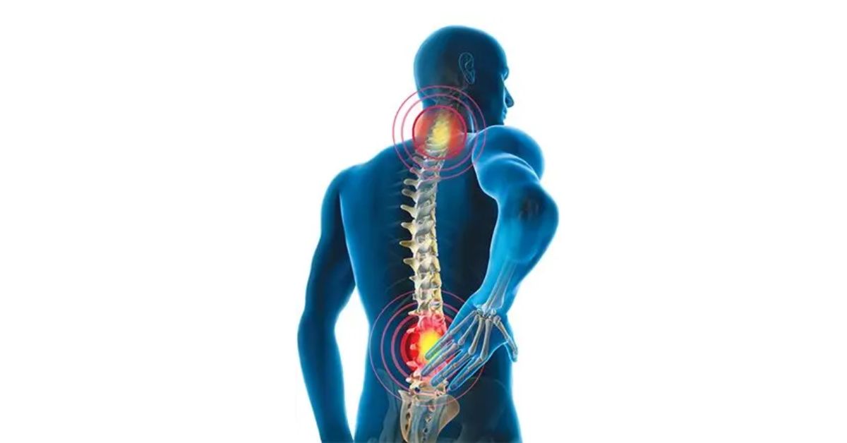 definition-and-types-lumbar-lordosis-vs-cervical-lordosis