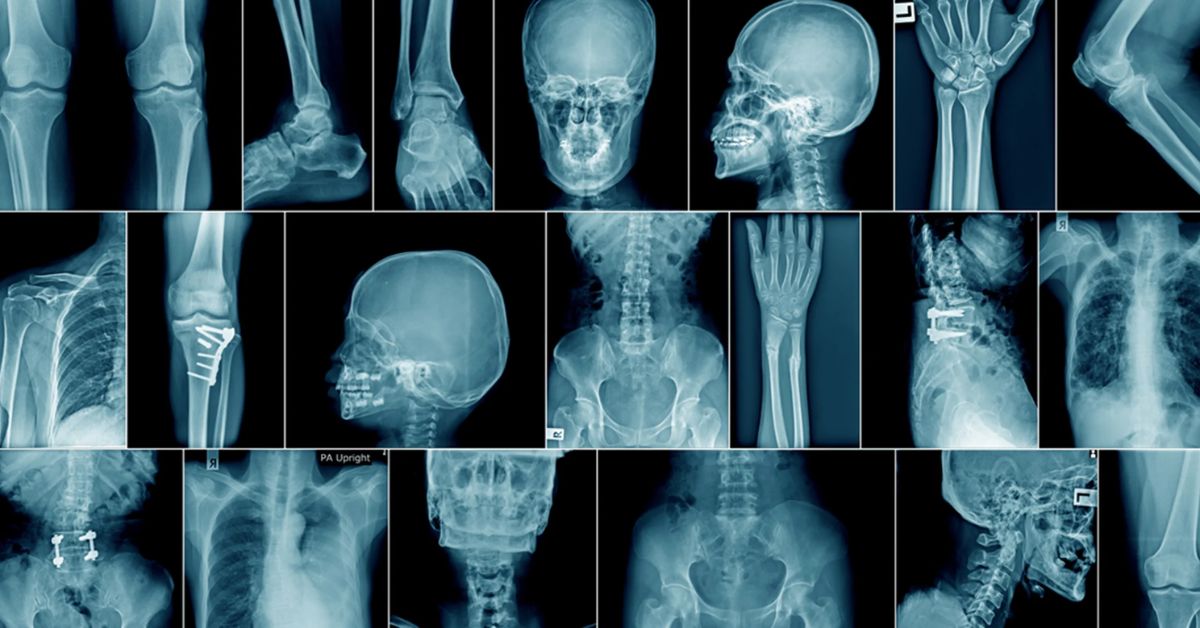 radiography-across-the-body
