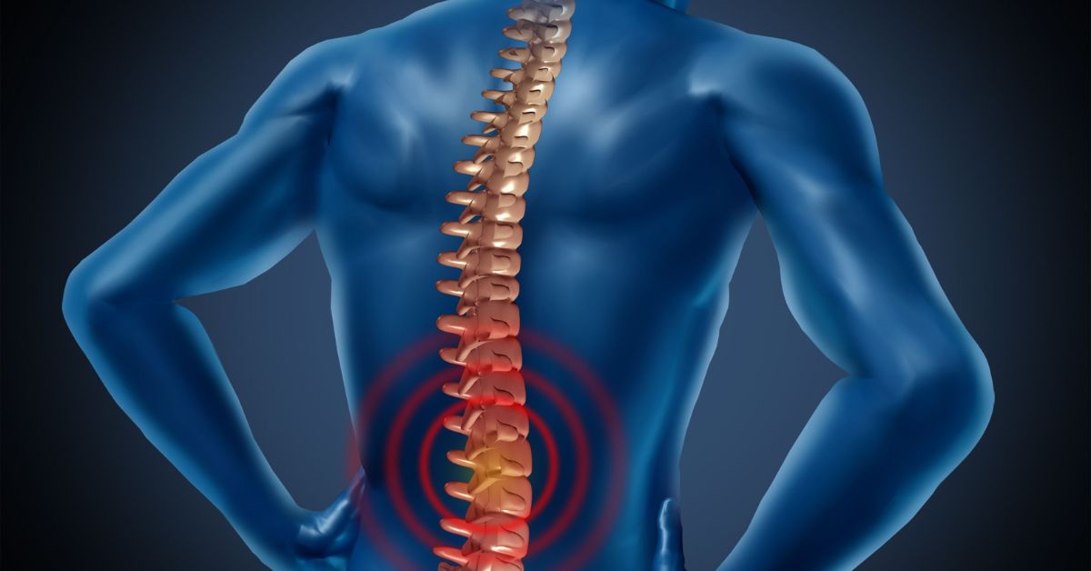 understanding-lordosis