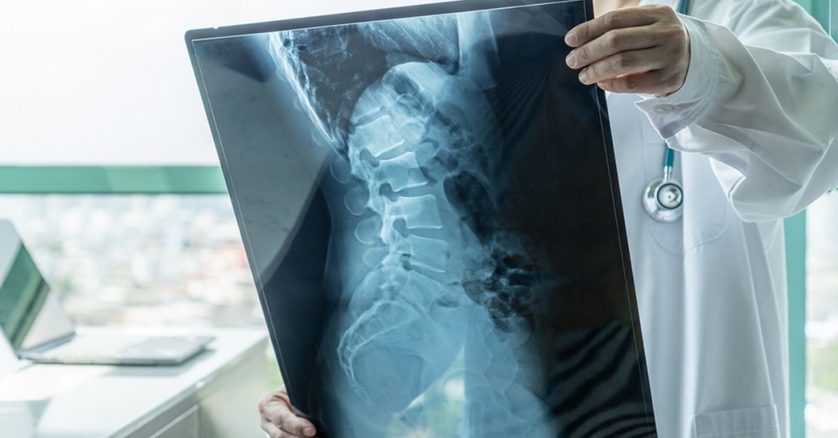 understanding-radiography-results