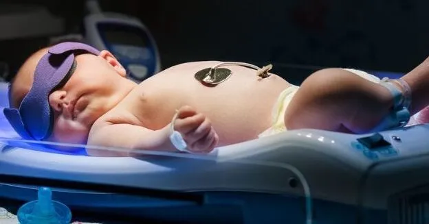 phototherapy-for-newborns