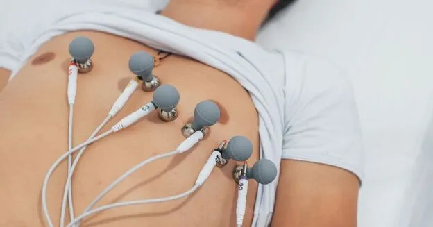 what-is-an-electrocardiogram-ecg-or-ekg