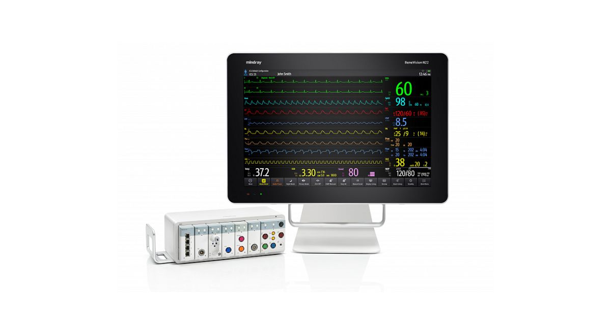 why-are-patient-monitors-essential-in-healthcare