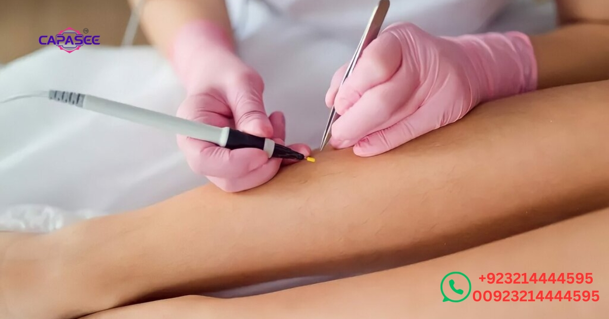 cautery-healing-stages-and-skin-recovery-after-the-procedure