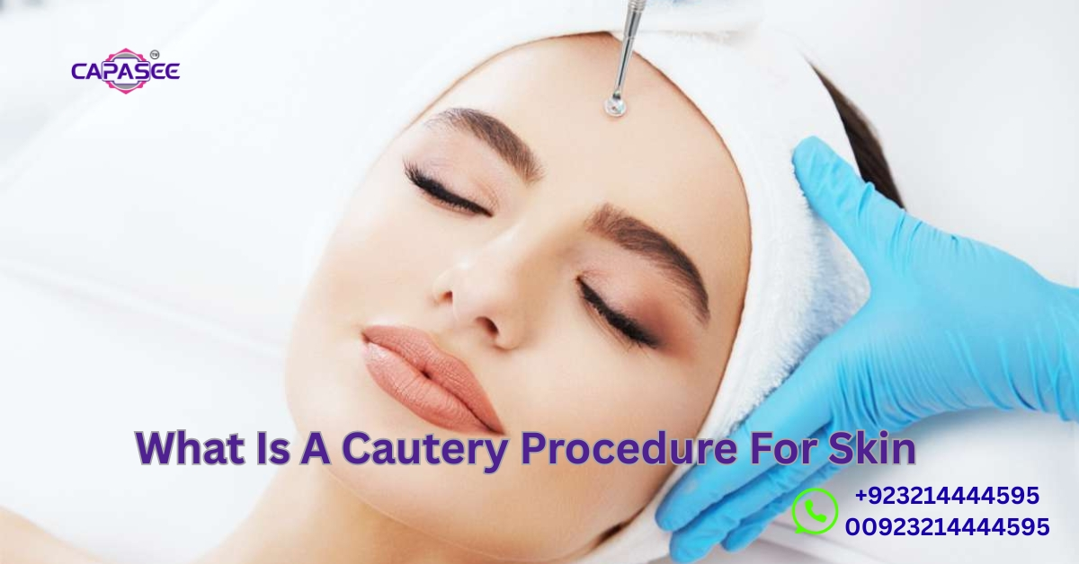 Cautery Procedure For Skin