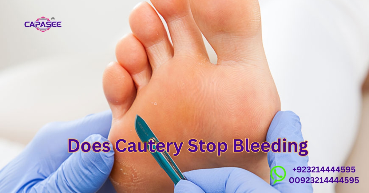 Cautery Stop Bleeding