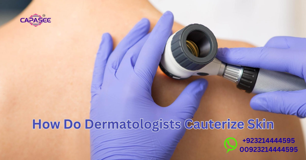 Dermatologists cauterize skin
