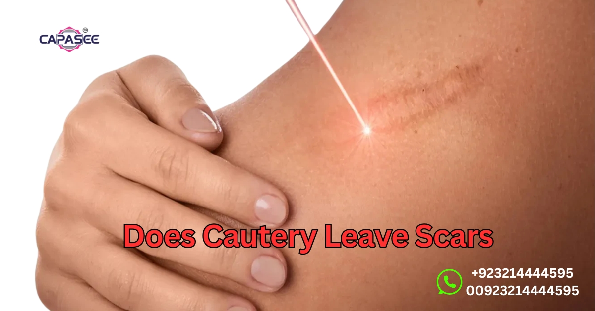 Does Cautery Leave Scars