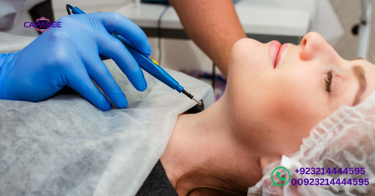 electrocautery-vs-other-treatments