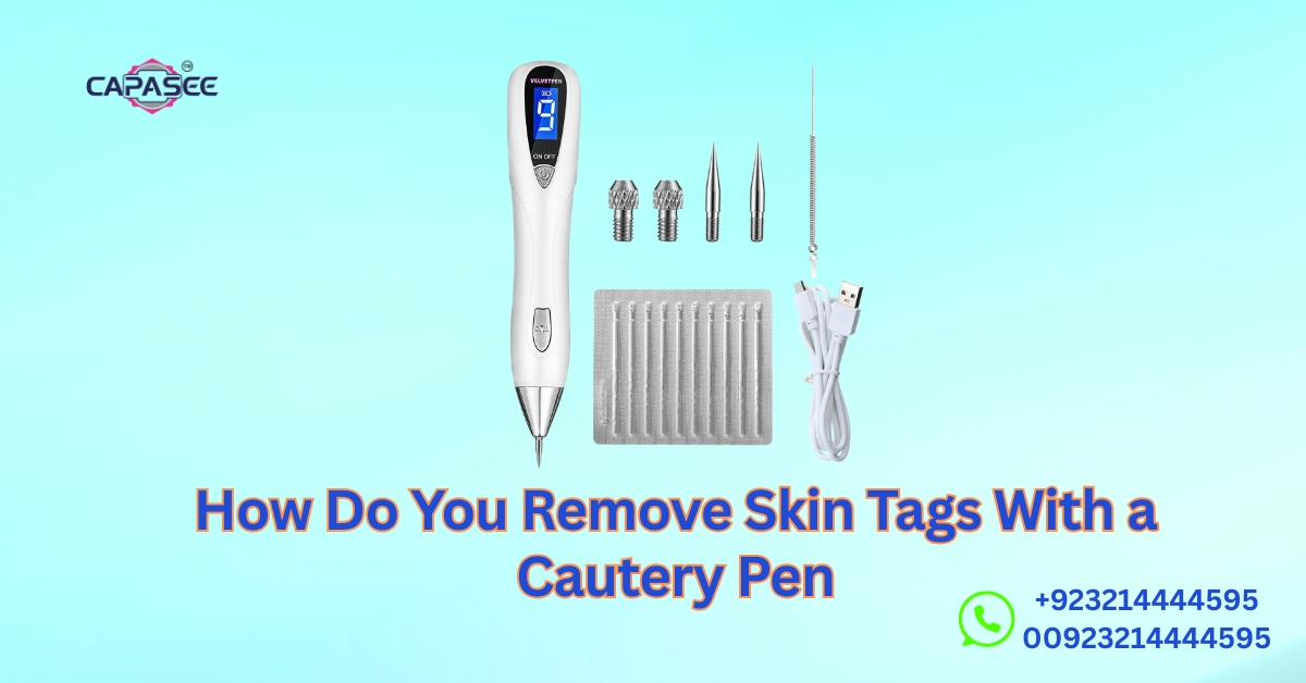 How Do You Remove Skin Tags With a Cautery Pen