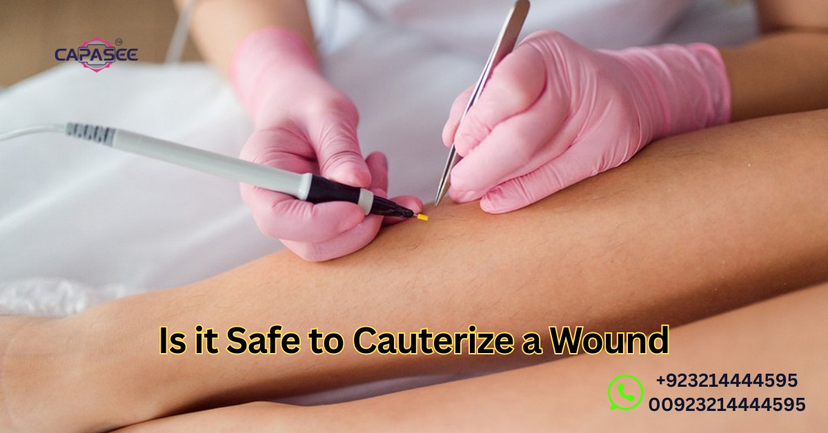 Is it Safe to Cauterize a Wound