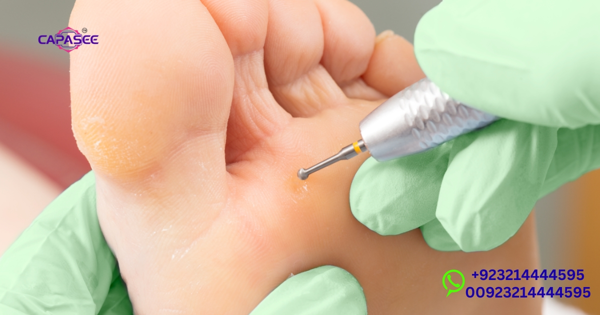 maximizing-recovery-wart-removal-healing-timeline-and-scar-prevention