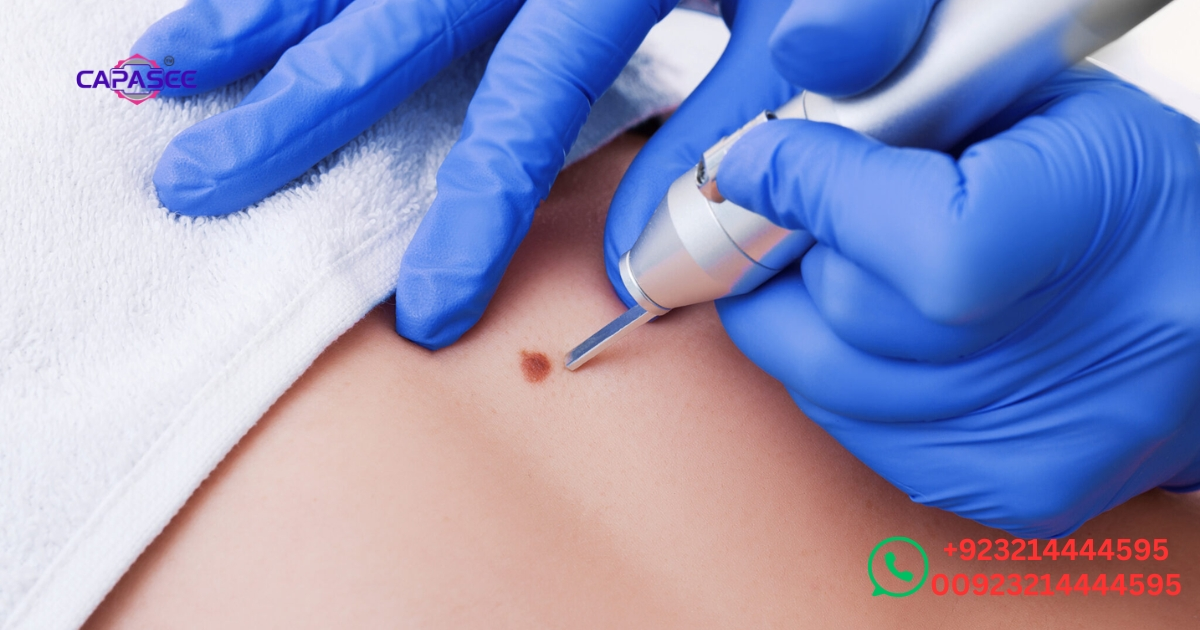post-cautery-care-tips-for-faster-recovery-and-minimal-scarring