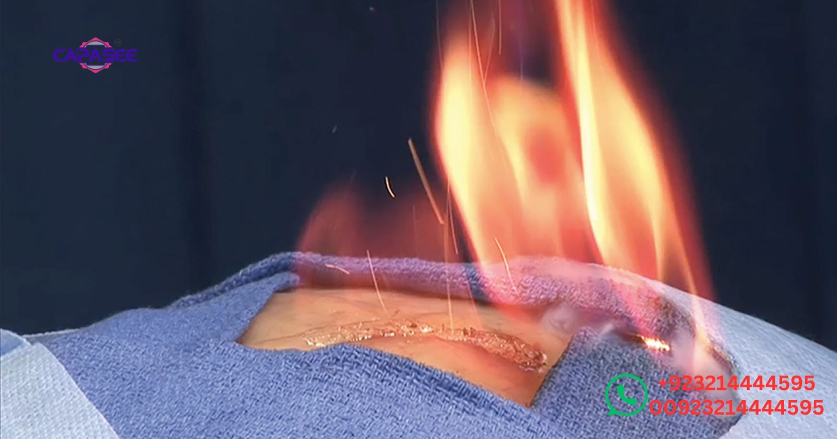 preventing-surgical-fires-during-electrocautery-safety-protocols-every-surgeon-should-know