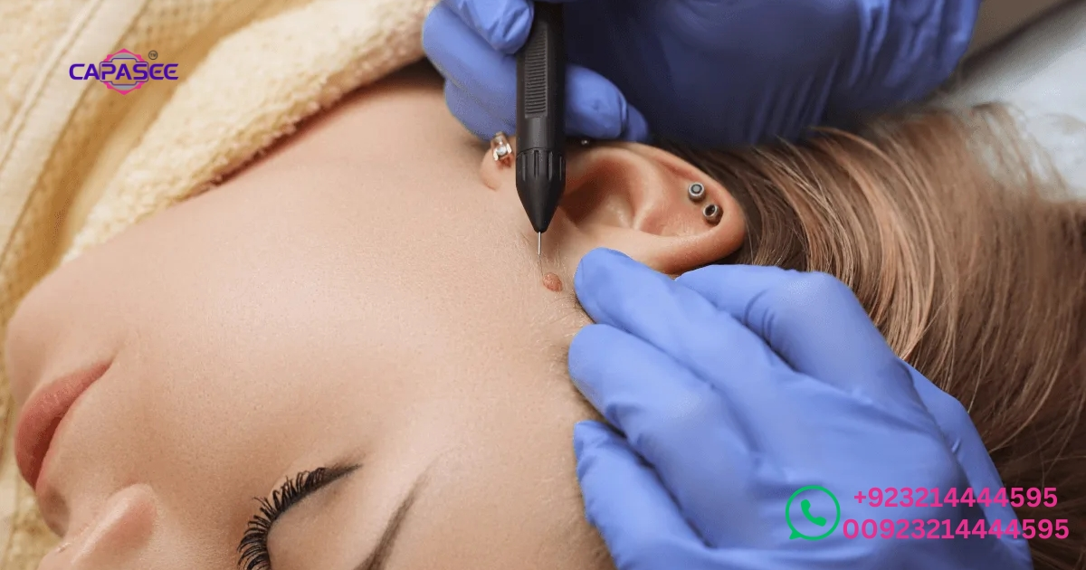 proven-strategies-to-enhance-cautery-healing-time-and-avoid-complications