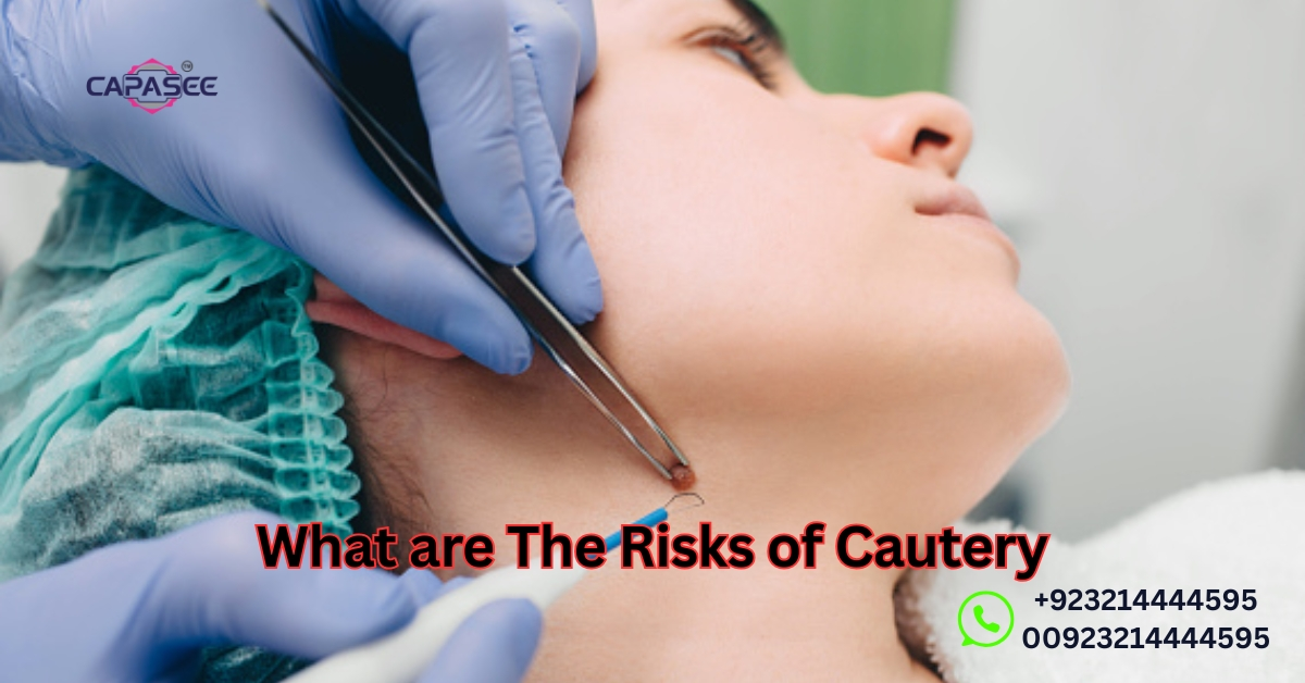 Risks of Cautery