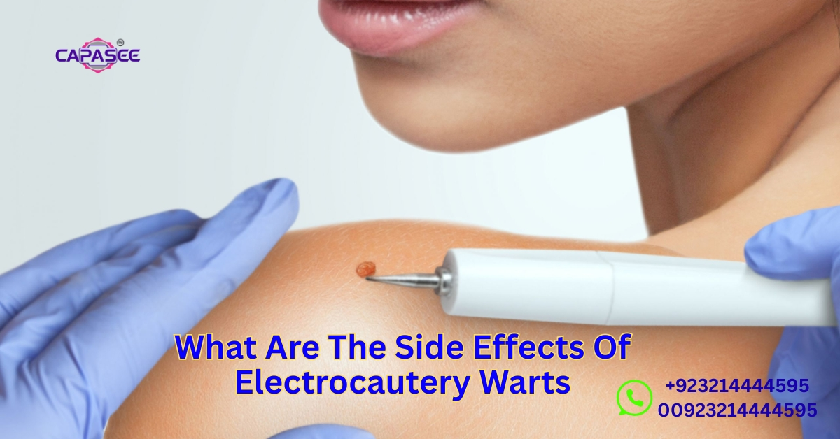 Side Effects Of Electrocautery Warts
