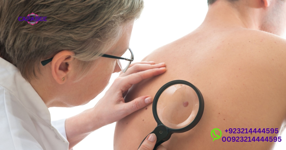 skin-cancer-and-pre-cancerous-lesion-treatment
