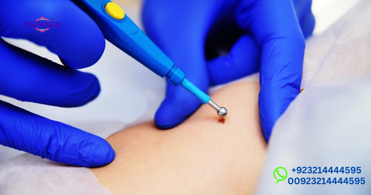 skin-healing-time-after-cautery-capasee-electro-medical-engineering-expert-guide