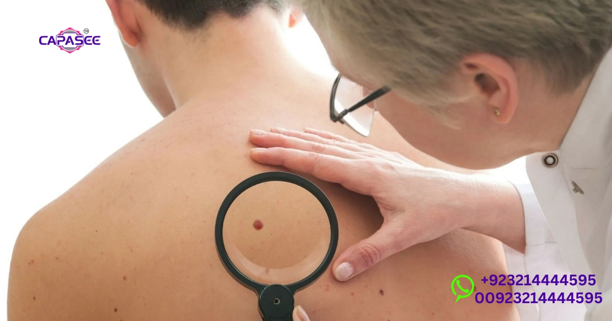 skin-lesion-removal-and-aftercare-with-capasee-electro-medical-engineering