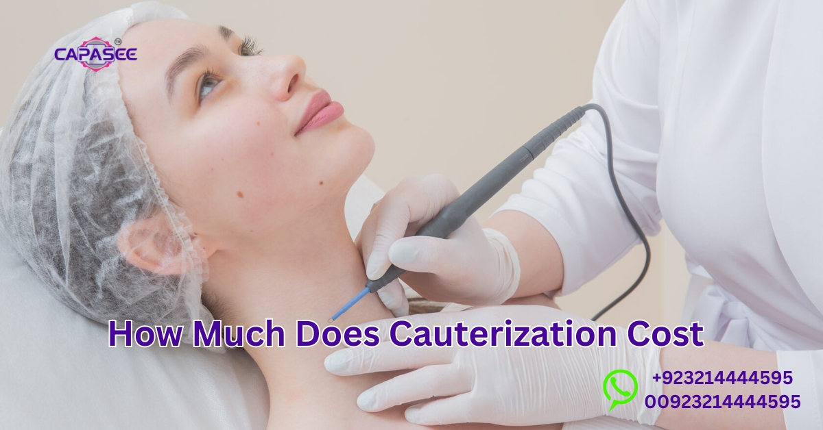 Cauterization Cost