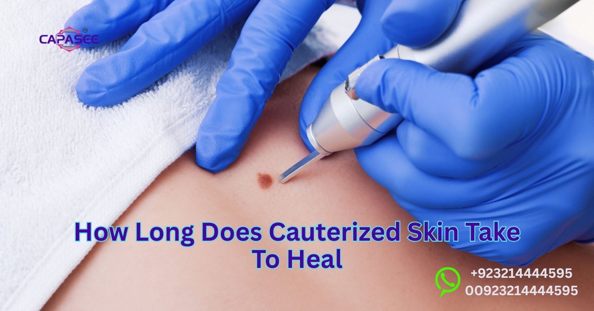 Cauterized Skin