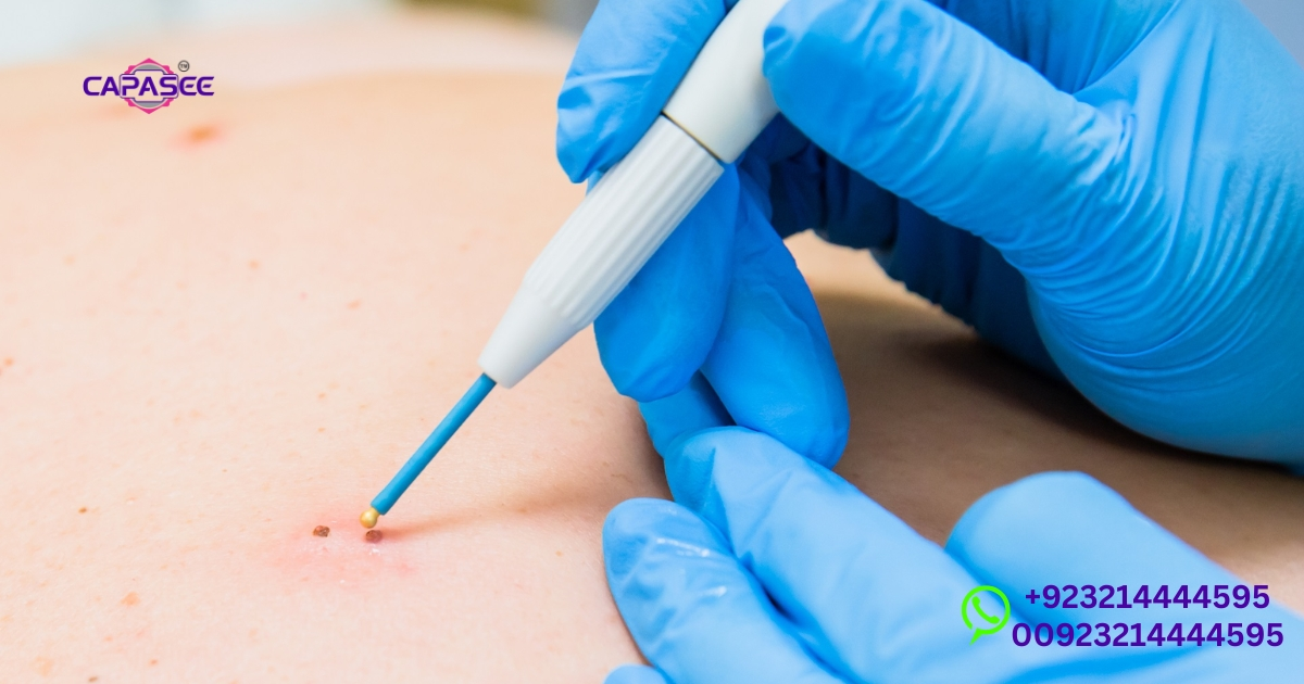 healing-process-and-potential-complications-after-skin-cauterization