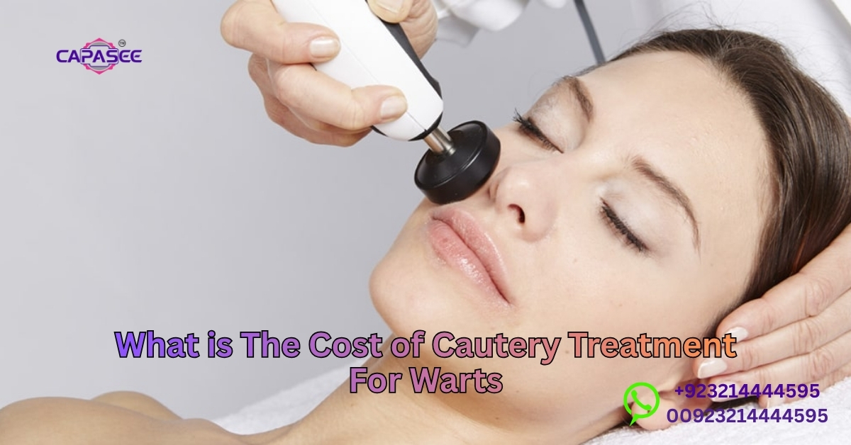 Cost of Cautery Treatment For Warts