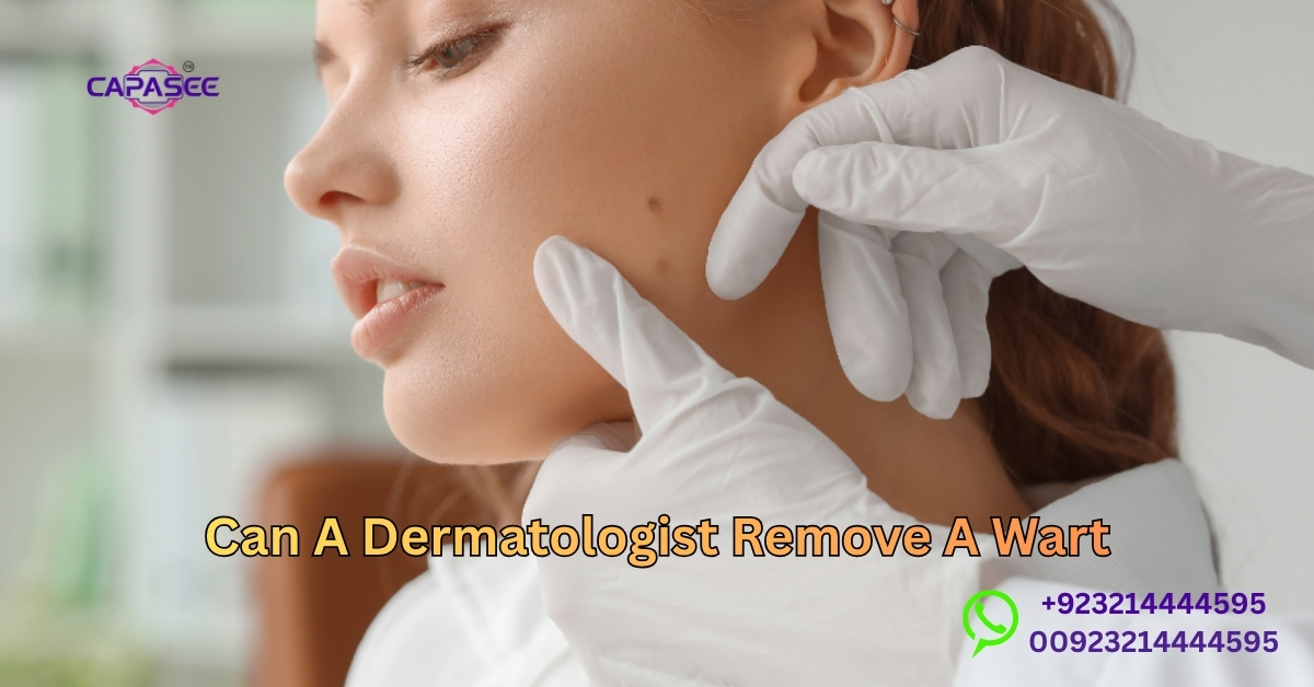 Dermatologist Remove A Wart
