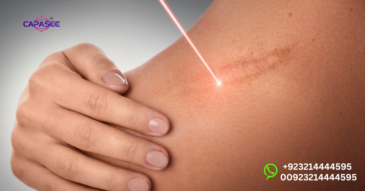 Laser Surgery vs Cautery Healing Time