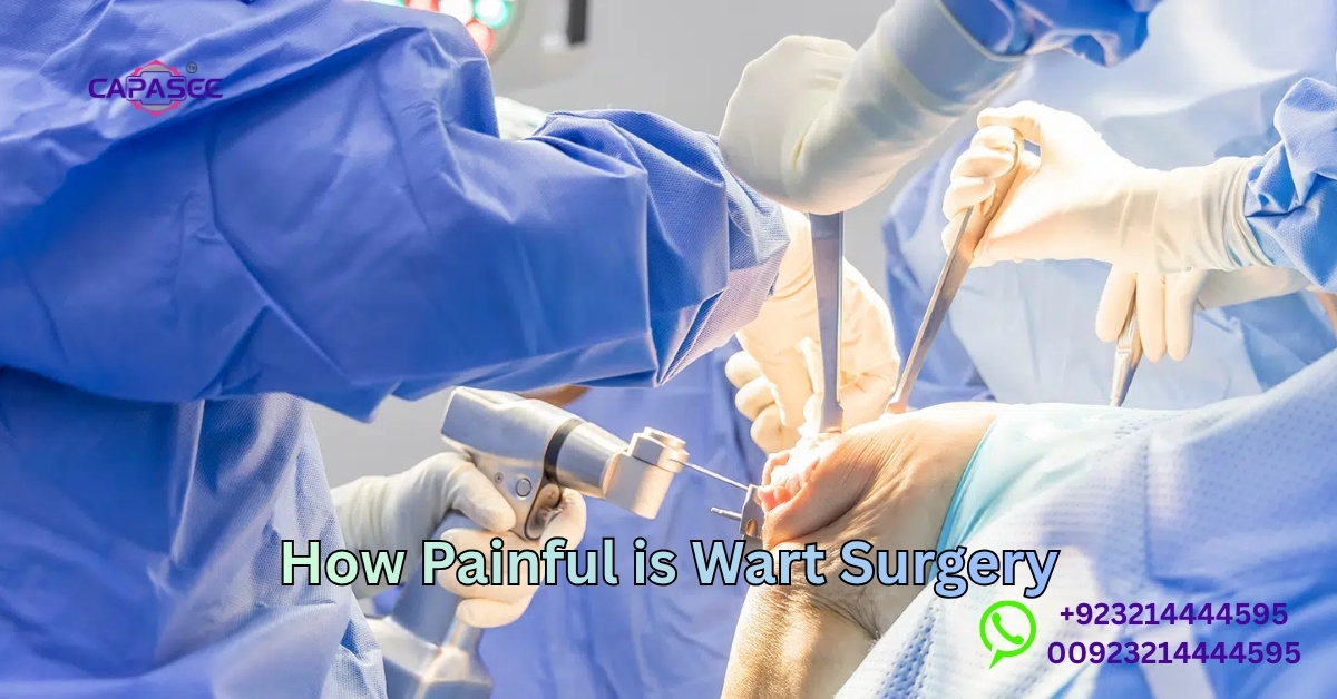 Painful is Wart Surgery
