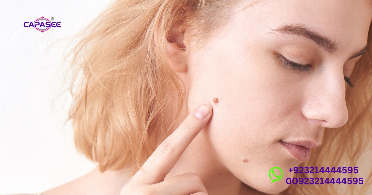 Side Effects of Cautery Treatment for Warts