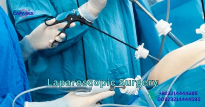 Laparoscopic Surgery