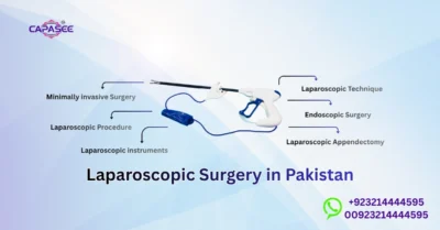 Laparoscopic