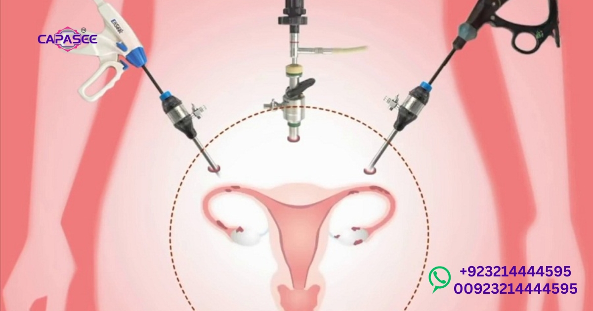 Recovery After Laparoscopic Hysterectomy in Pakistan