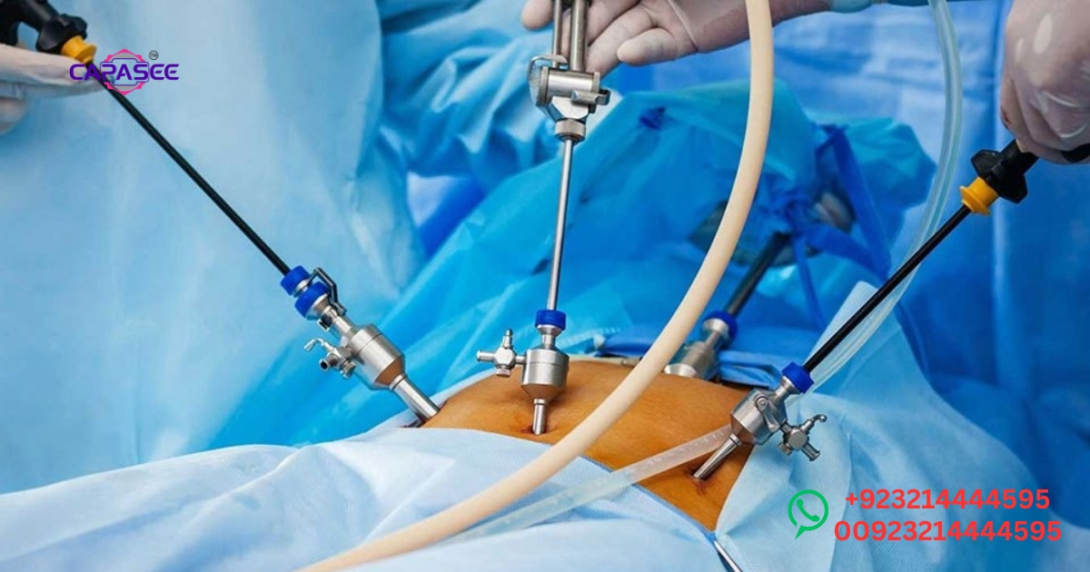 TLH vs Abdominal Hysterectomy in Pakistan