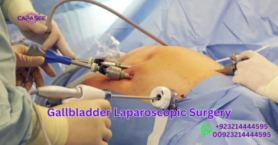 Gallbladder Laparoscopic Surgery