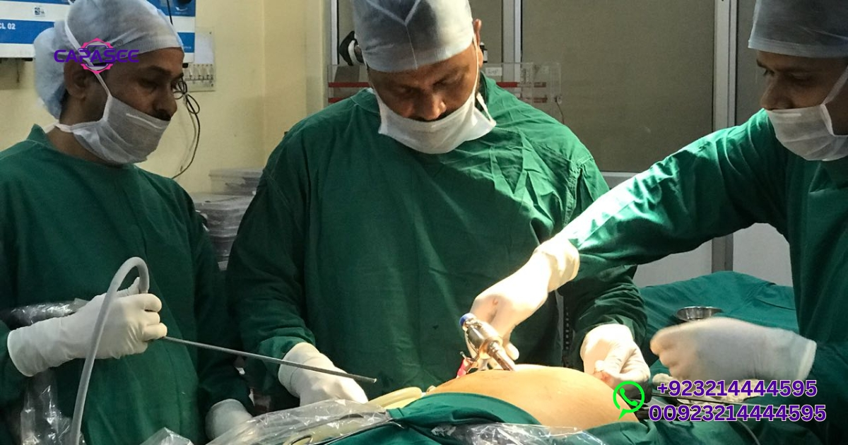 Lap Chole Surgery Lahore – Top Benefits