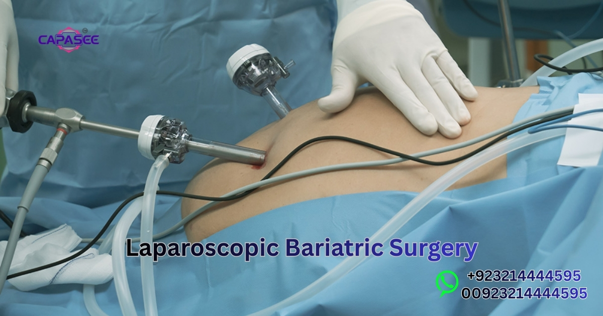 Laparoscopic Bariatric Surgery