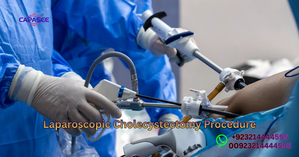 Laparoscopic Cholecystectomy Procedure