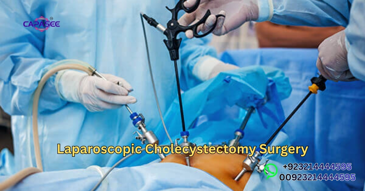 Laparoscopic Cholecystectomy Surgery