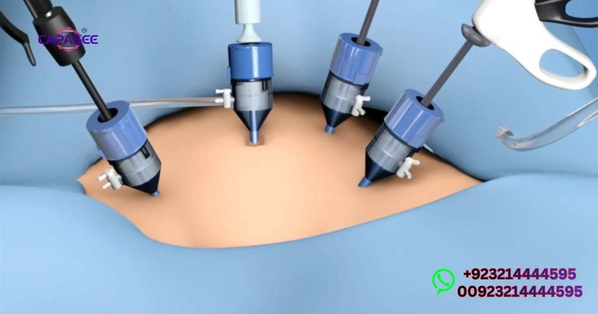 Laparoscopic Gallbladder Surgery Cost in Pakistan