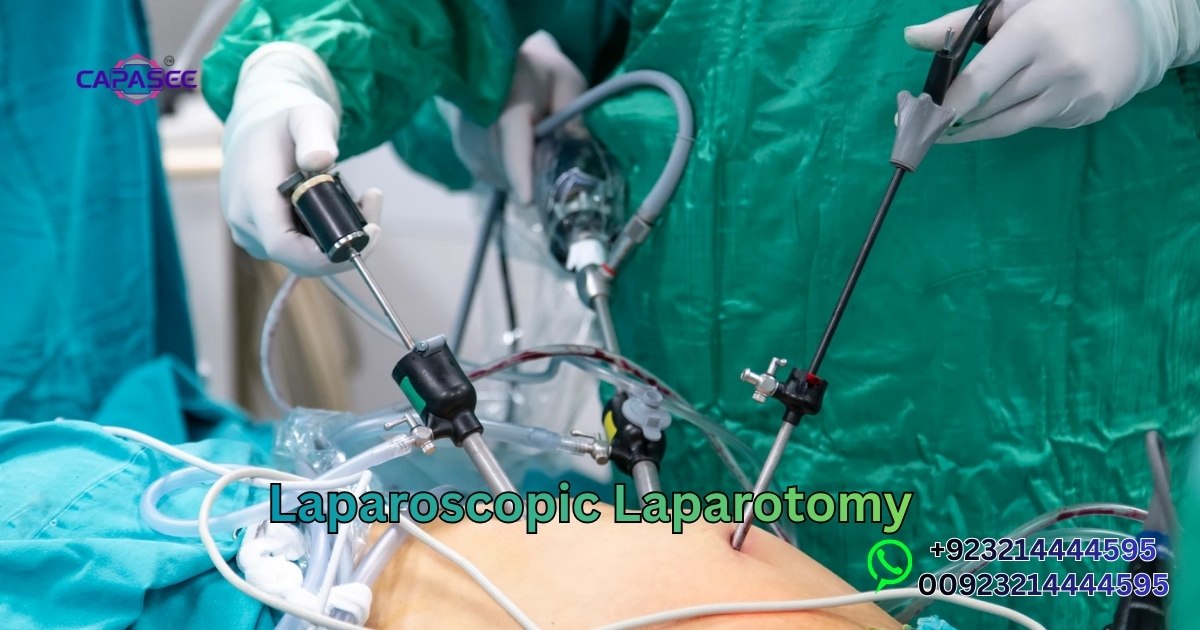 Laparoscopic Laparotomy