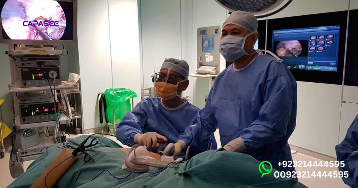 Laparoscopic Nephrectomy: Radical vs. Simple Surgery