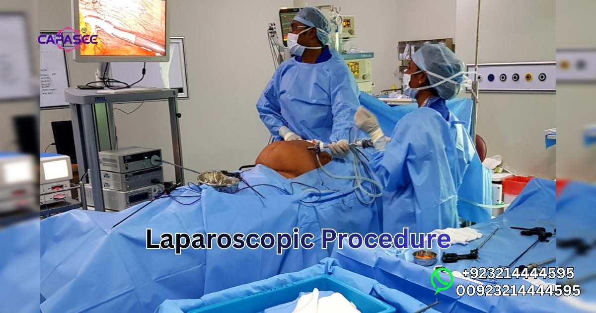 Laparoscopic Procedure